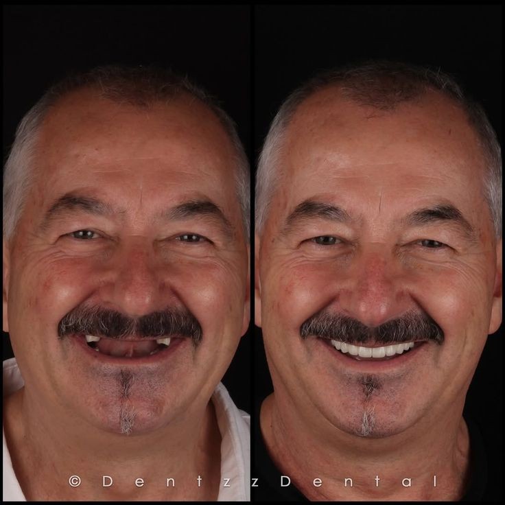Cosmetic Dentistry
